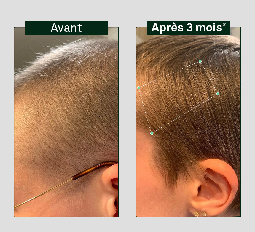 image avant/après