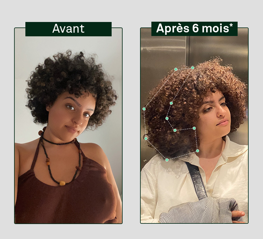 image avant/après