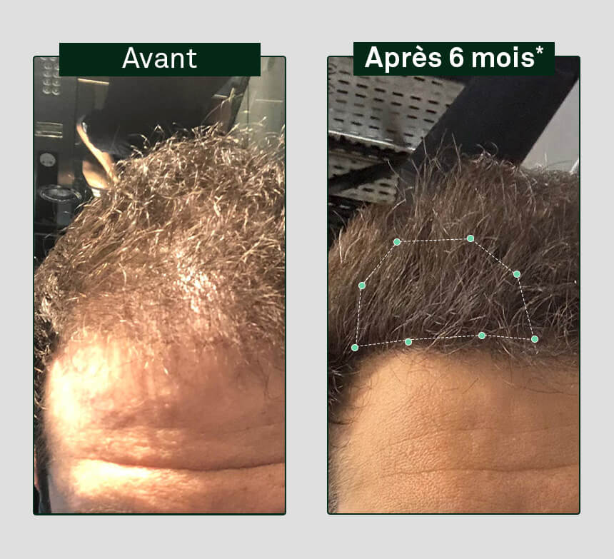 image avant/après Shampooing Pousse Ramy